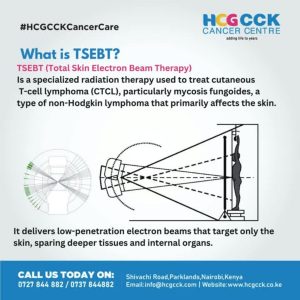 TSEBT HCG CCK Cancer Centre